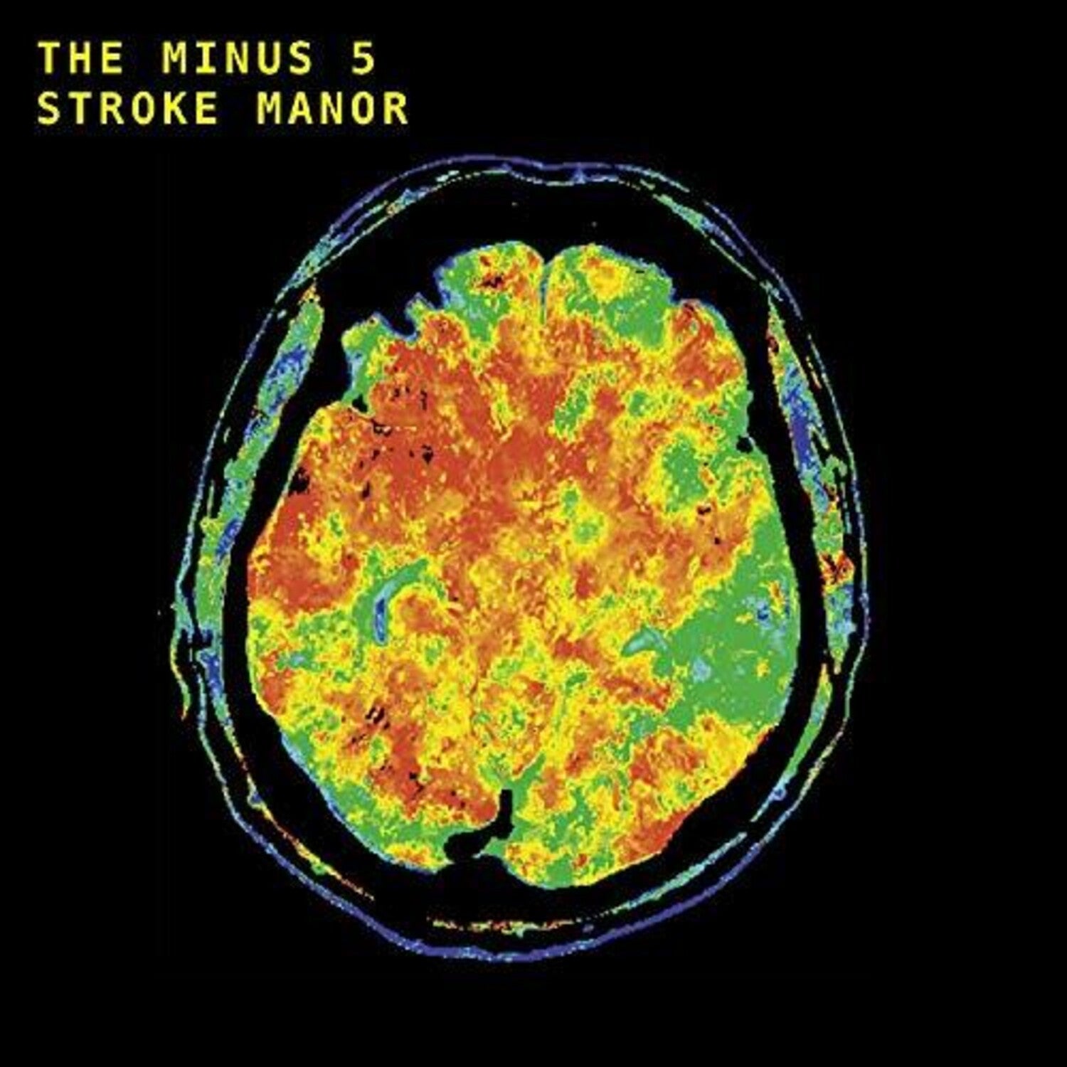 Minus 5 - Stroke Manor