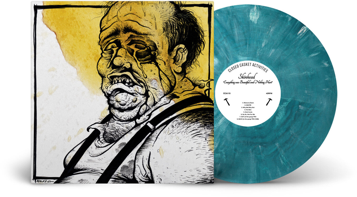 Skinhead - Everything Was Beautiful, And Nothing Hurt (Silver Vinyl)